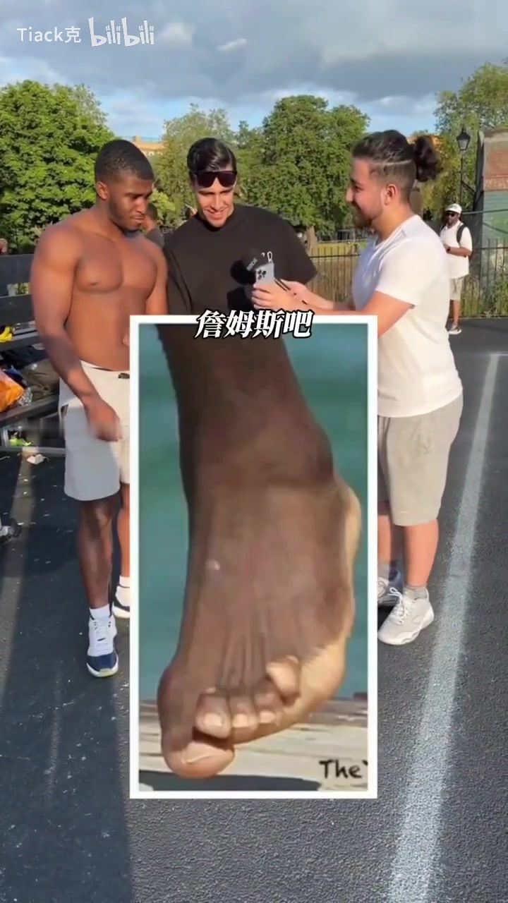 视频会引起不适！职业球员的代价，这竟然是詹姆斯和哈登的脚？